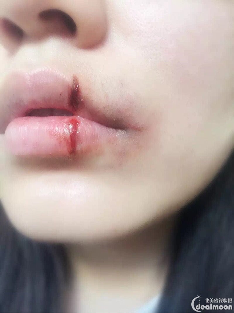 鼻青脸肿被打妆