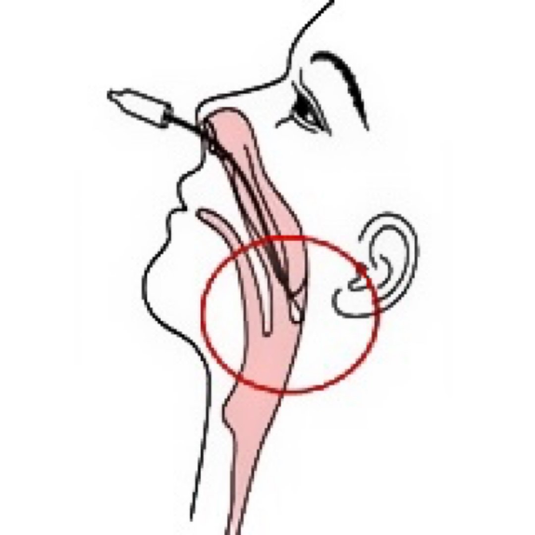 回国做鼻拭子核酸检测太难受,教你如何缓解