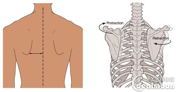 如果在两臂自然下垂时,肩胛骨靠近脊柱侧突起明显,就是scapular pro