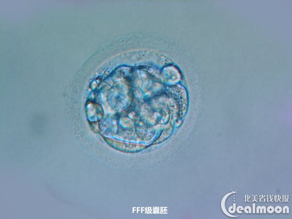 fff级囊胚版权属于fst诊所