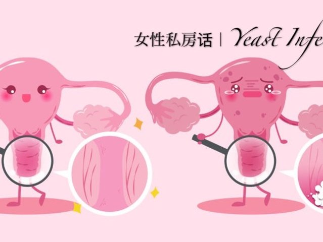 女性私房话 - 在澳洲得了Yeas...