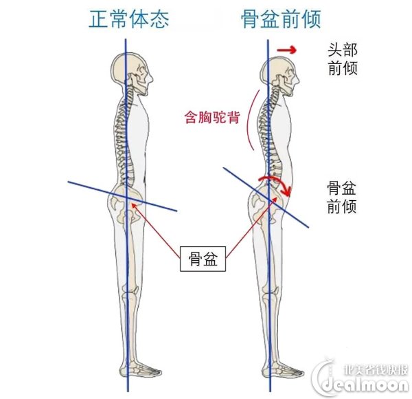 在保持头部和肩部屁股紧贴墙面的情况下,来观察一下, 正常人的背部与