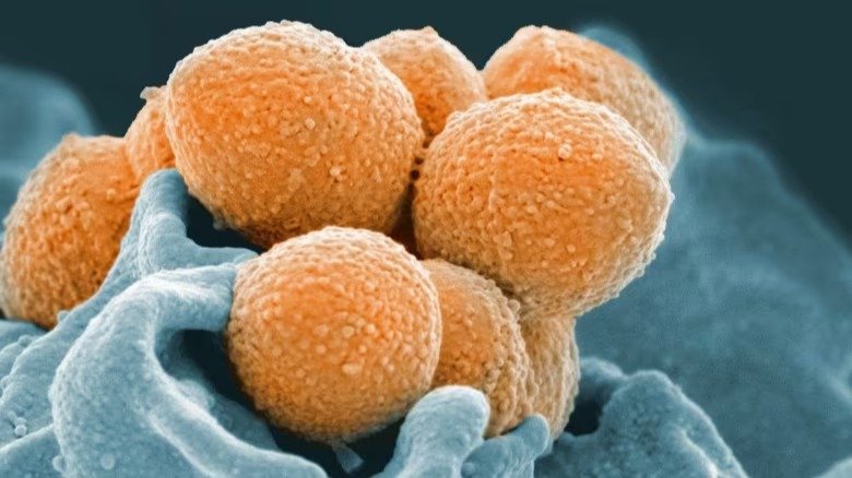 发病率异常！BC省一个月内4名儿童死于“A型链球菌”，其他呼吸道疾病一起被发现！