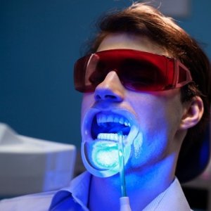 Tantric Tanning 专业牙齿美白护理 20分钟还你亮白笑容