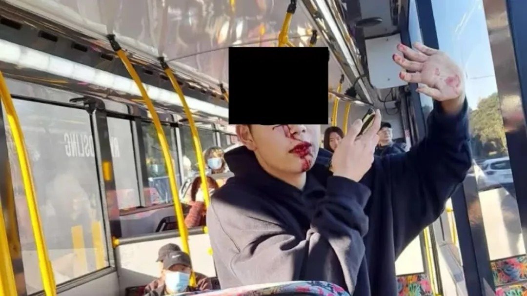 16岁中国留学生在公交车上被无端殴打！一车人却只有75岁老人出手相助？！