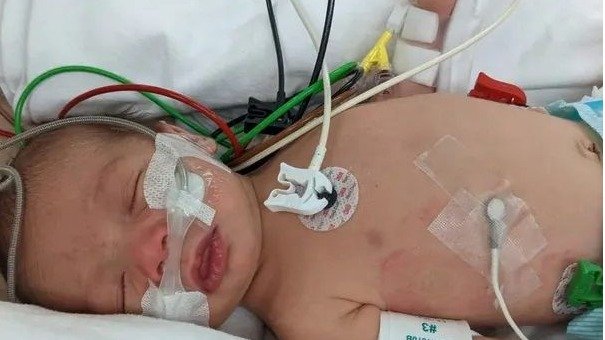 安省出生仅12天婴儿感染RSV，生命垂危医院两次拉响警报！紧急转院SickKid后获救！