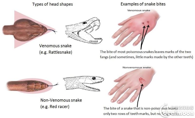 被毒蛇咬伤的伤口 vs 被无毒蛇咬伤的伤口