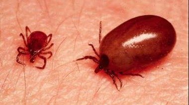 加拿大防蜱虫(Ticks) 攻略 - 安省报告超60例莱姆病！被叮症状、如何防治莱姆病！