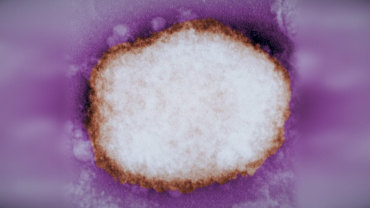猴痘（Monkeypox）全球爆发！台湾地区出现首例猴痘病例，全球病例数上升至 3,200 多例！世卫组织考虑宣布猴痘为全球卫生紧急情况