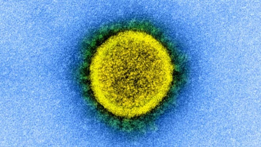 警惕！BC省发现加拿大第一例高度突变的COVID-19病毒变种BA.2.86！