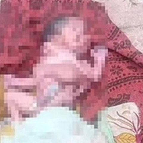 印度女子生下怪婴震惊全网！4条胳膊4条腿2张脸，只存活5小时！