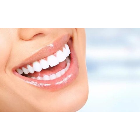 AALIYAH 牙齿美白套餐