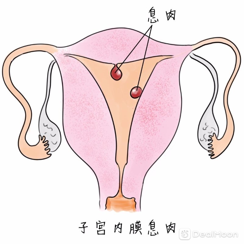 bf92dfbb0ecf44ba814ec02.jpg