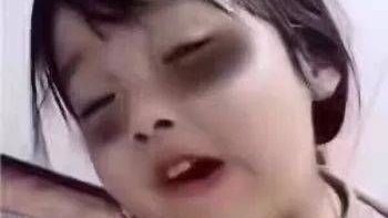 【黑眼圈怎么救?】姐妹们注意防晒,保养,医美,学化妆!啥也不是,赶紧去睡觉!
