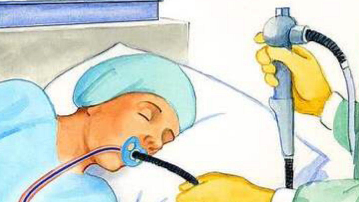 第一次在美国做肠胃镜检查
