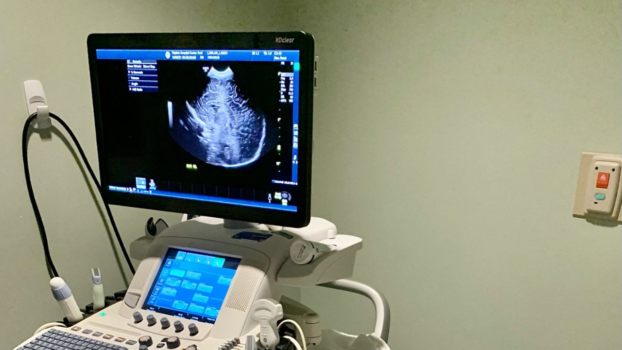 例行体检宝宝头围偏大⁉️二月龄宝宝头部超声扫描全记录