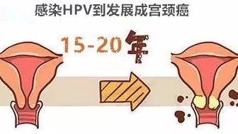 🐰｜【关于HPV疫苗】
