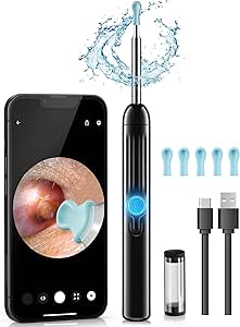 Amazon.com: Jegoat Ear Wax Removal, 1080P HD Scope and 6 LED Lights, Ear Cleaner with Camera, Ear Cleaning Kit - Earwax Remover Tool with 5 Spoon (Onyx) : Health &amp; Household