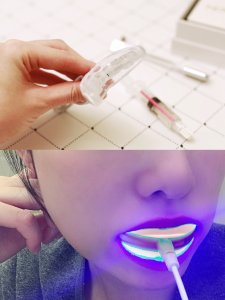 微众测｜Novashine - 洁白健康牙齿的好帮手