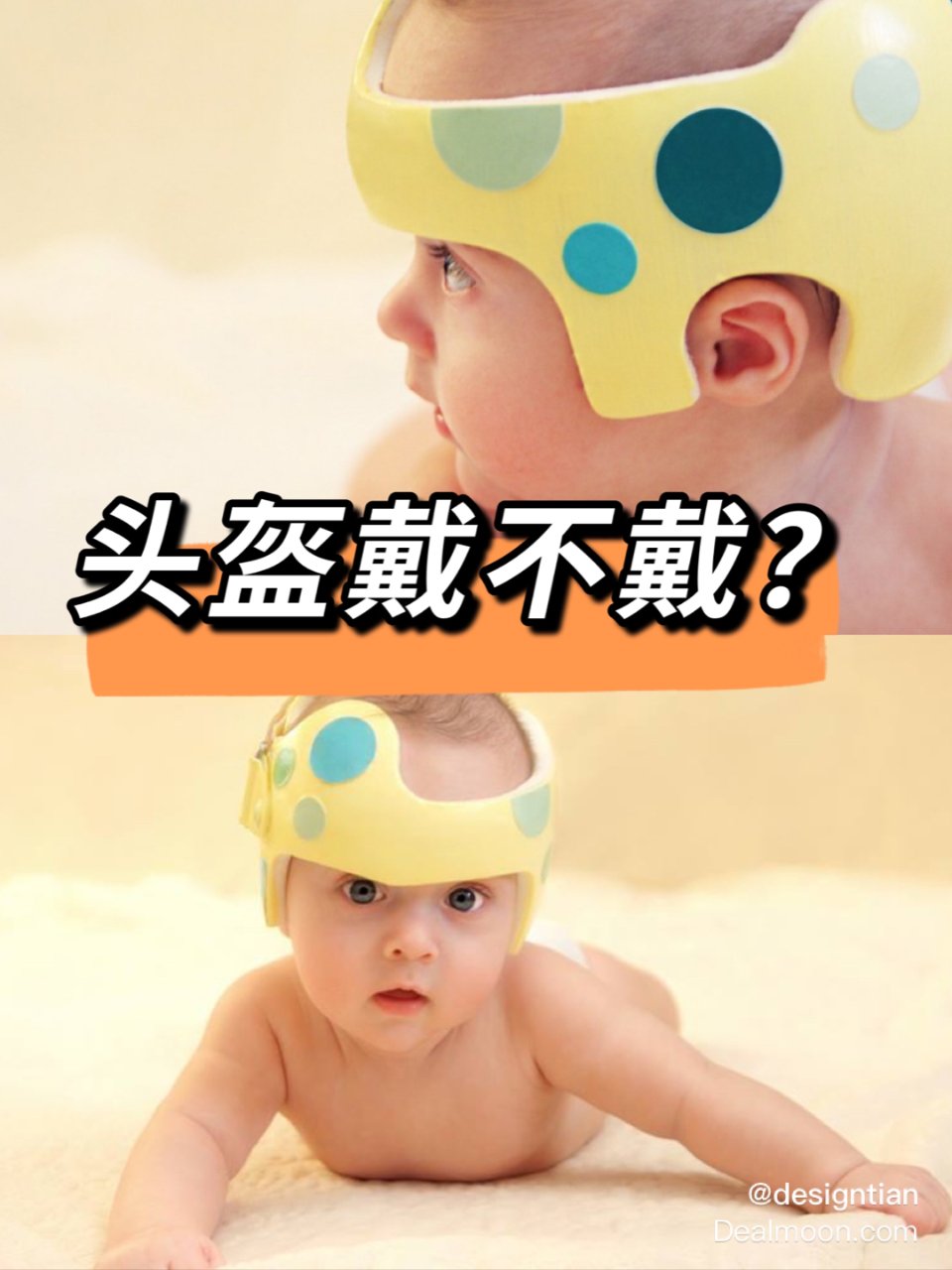 你家宝宝需要头盔吗❓戴头盔有什么缺点❓...
