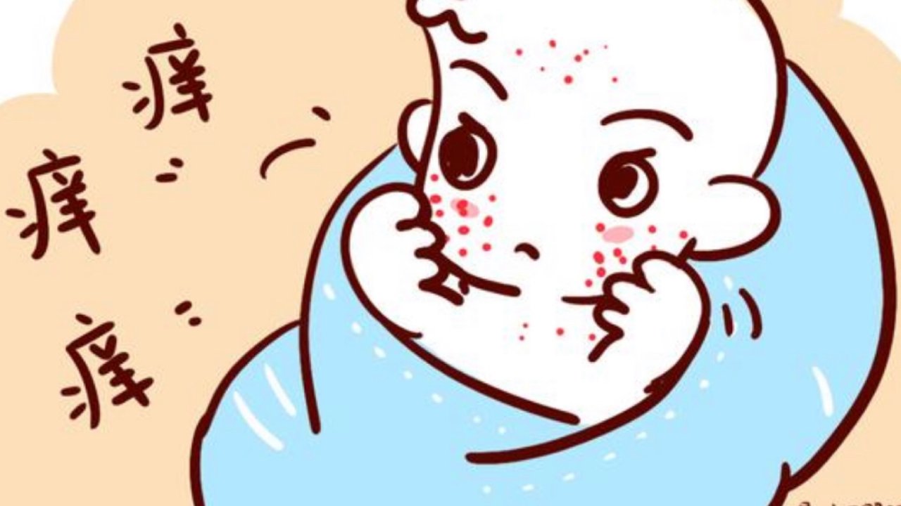 宝宝湿疹 “抗战”1 – 常规方法篇