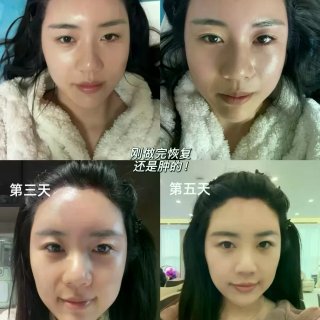 产后 9 个月｜我的发际线终于救回来了✨...