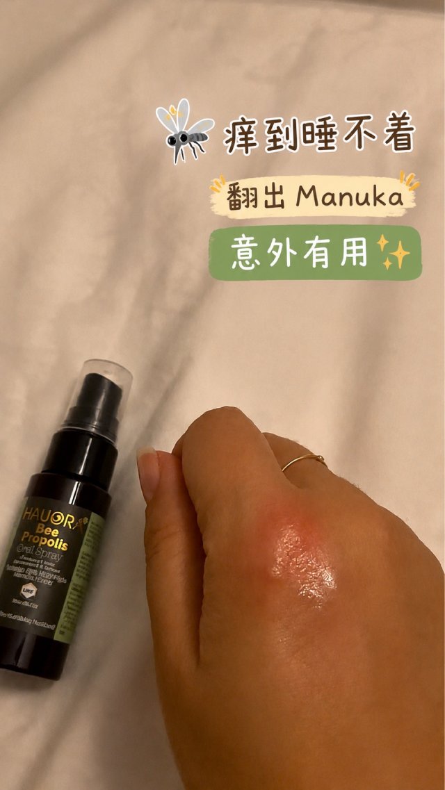半夜被蚊子咬到痒醒😭