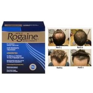 Rogaine for Men Hair Regrowth Treatment, Original Unscented, 2 Oz, Three Month Supply