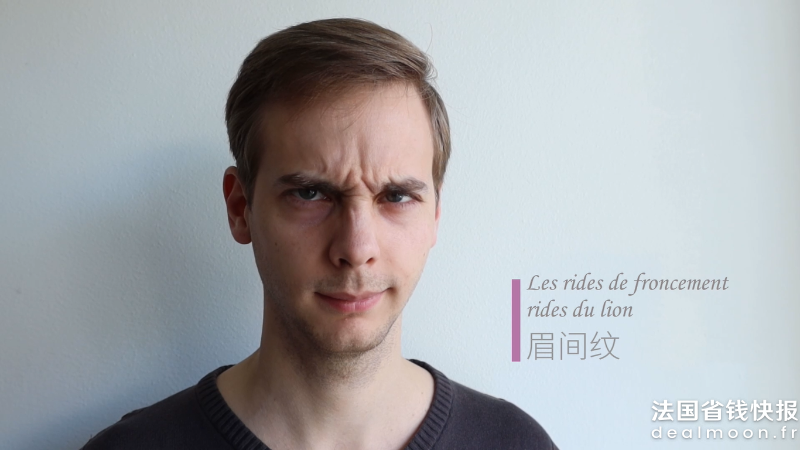 眉间纹
