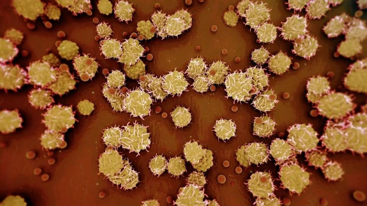 纽约州首次报告未成年人感染猴痘