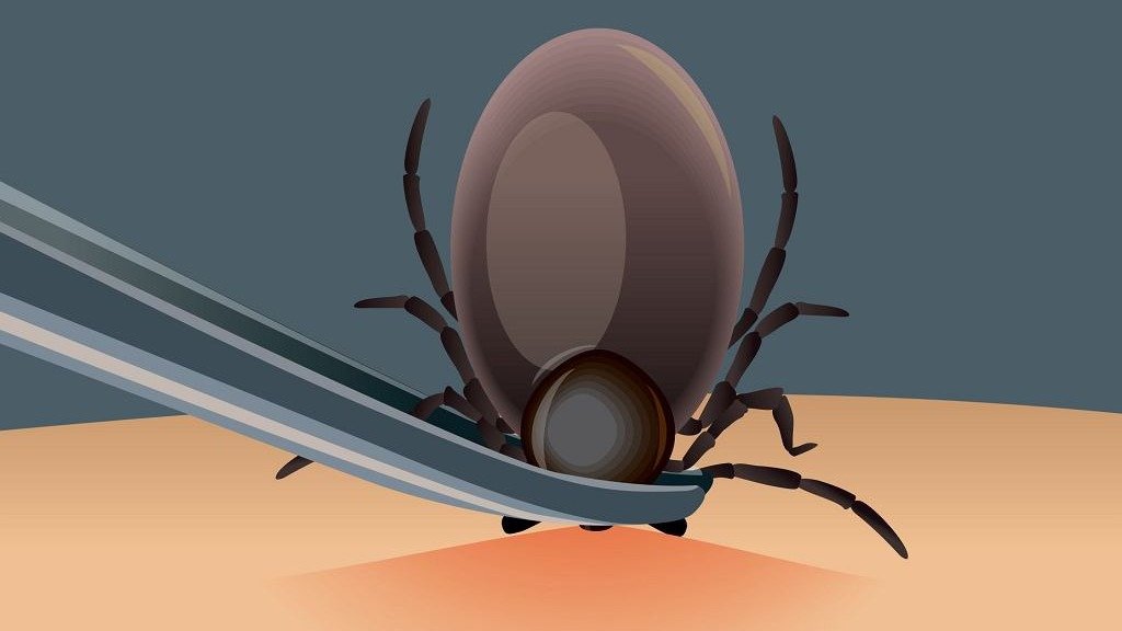 夏天慎防蜱虫(Ticks) | 被蜱虫叮了怎么办？蜱虫伤口、症状，如何防治莱姆病