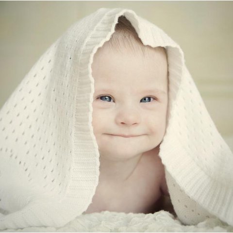 More Smiles!Treatments For Baby Eczema