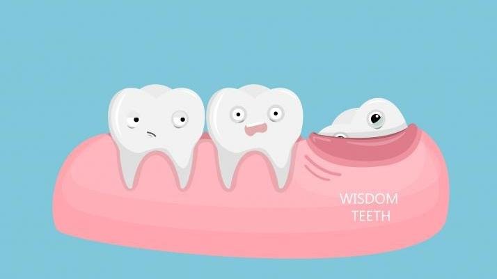 牙医为你解惑---关于智齿拔除手术的十大迷思