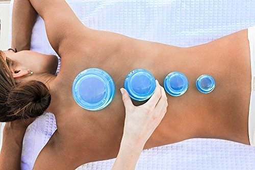 Cupping Therapy Massage Sets - Silicone Vacuum Suction Cupping Cups for Muscle and Joint Pain Cellulite & More (Brilliant Blue, 4)