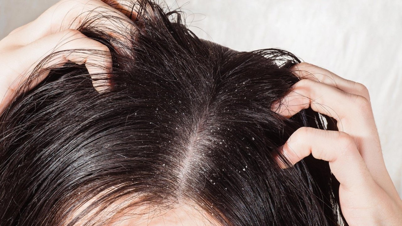 城市污染导致你的头皮又油又痒？ 如何有效的清除残留物，抵抗污染对头发的伤害