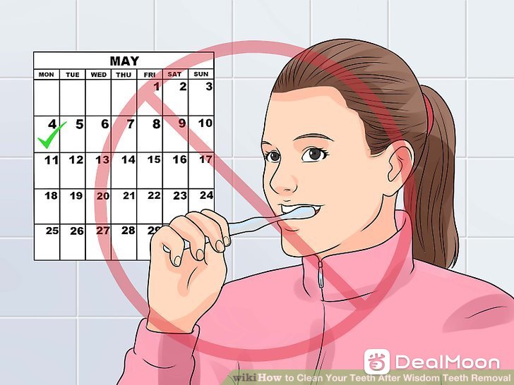aid4870335-v4-728px-Clean-Your-Teeth-After-Wisdom-Teeth-Removal-Step-2-Version-2.jpg