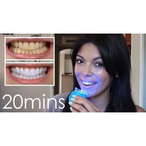 Whitening Lightning® Bright Express - Professional Teeth Whitening Kit