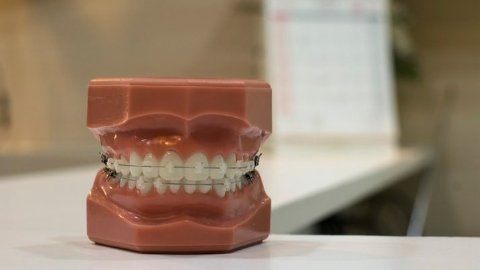 局麻植牙是怎样一种体验。附带一些关于牙齿护理的小贴士。-北美省钱 