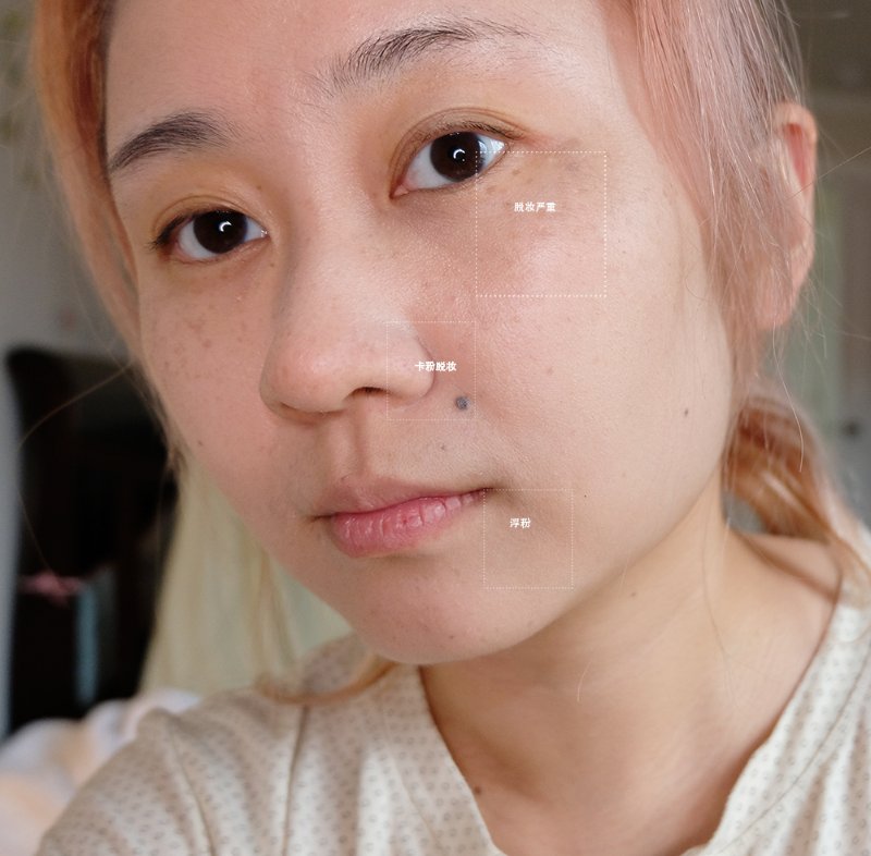 Surratt 4小时后.jpg