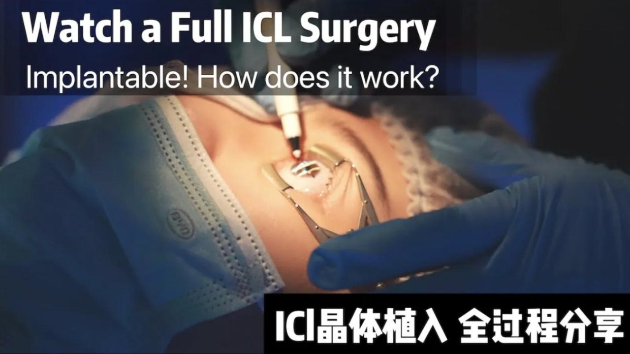 1250度近视！EVO ICL近视手术全过程分享 什么步骤？花多少钱？如何选医生？