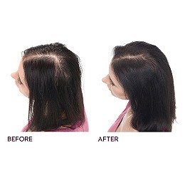 Hair Regrowth Treatment | Ulta Beauty