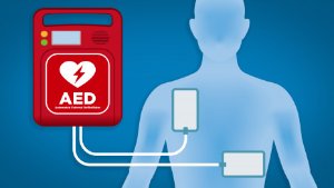 突发心脏骤停急救神器AED自动体外除颤仪怎么使用？把握黄金救命4分钟！