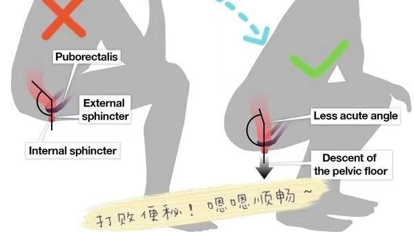 个人经验分享| 缓解便秘的方法，妙招💪和无用方法避雷💣