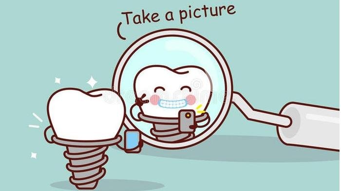 局麻植牙是怎样一种体验。附带一些关于牙齿护理的小贴士。