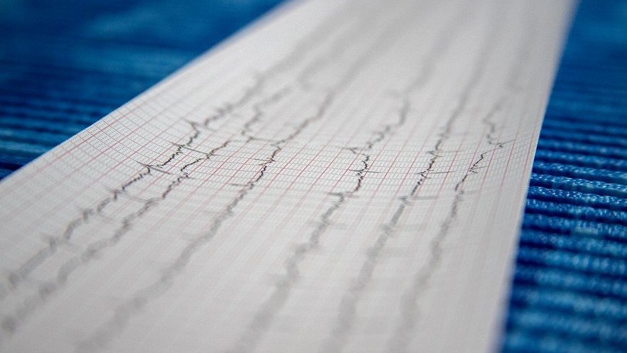 哪些因素会导致年轻人突发心脏病猝死？如何预防心源性猝死？