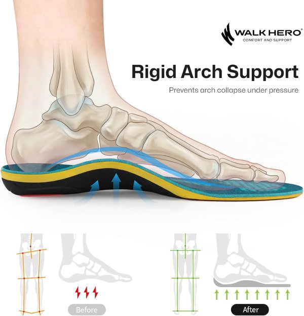 WalkHero High Arch Support Insoles Men’s 4-4.5 Coral Green