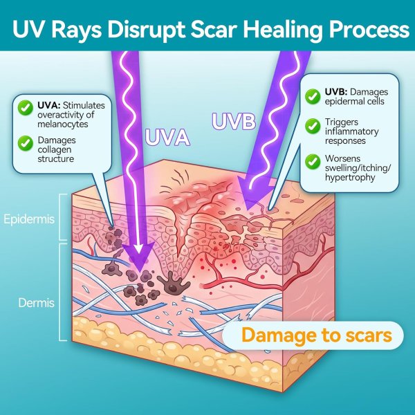Silicone Scar Sheets UPF50+ 1.6x78.7 Inch