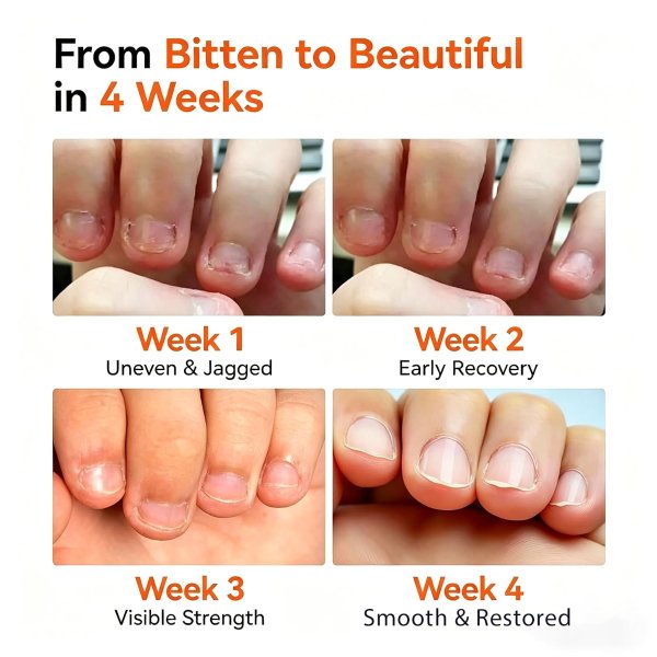   Nail Biting Prevention Bitter Polish 13.5ml for Kids and Adults